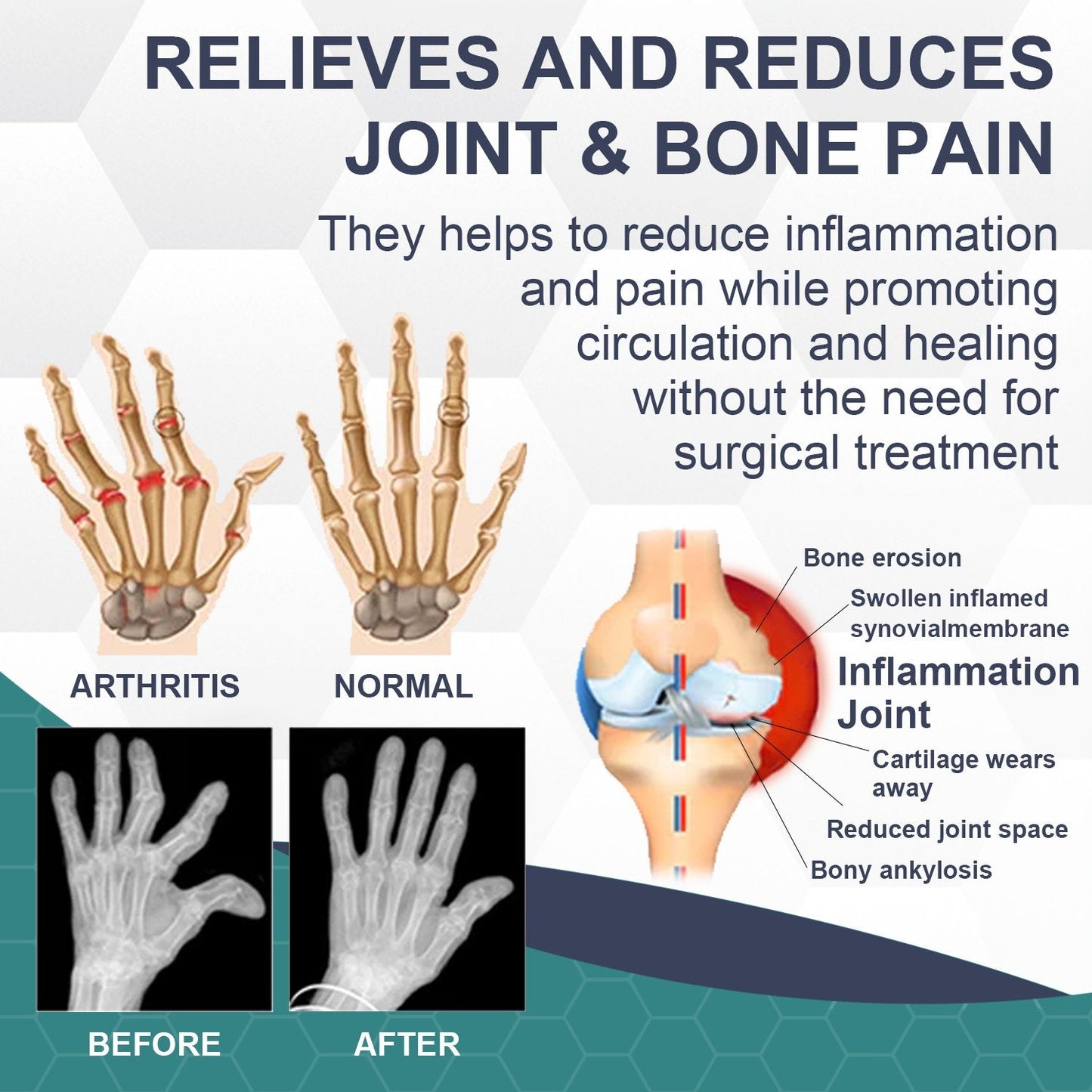 Bee Venom Pain and Bone Healing Cream